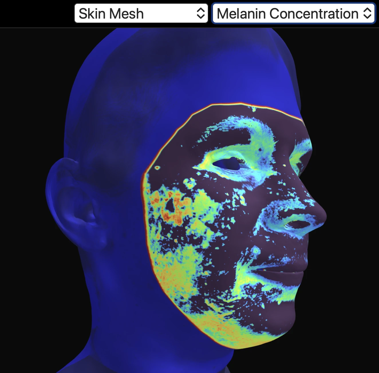 melanin